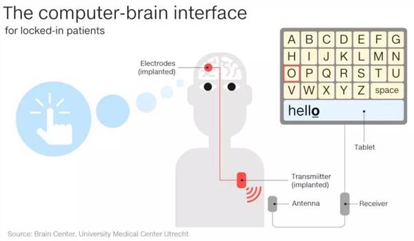 码报:【j2开奖】重磅 | 世界首例成功的人类脑机接口实验：让全身瘫痪病人可以通过思想进行交流