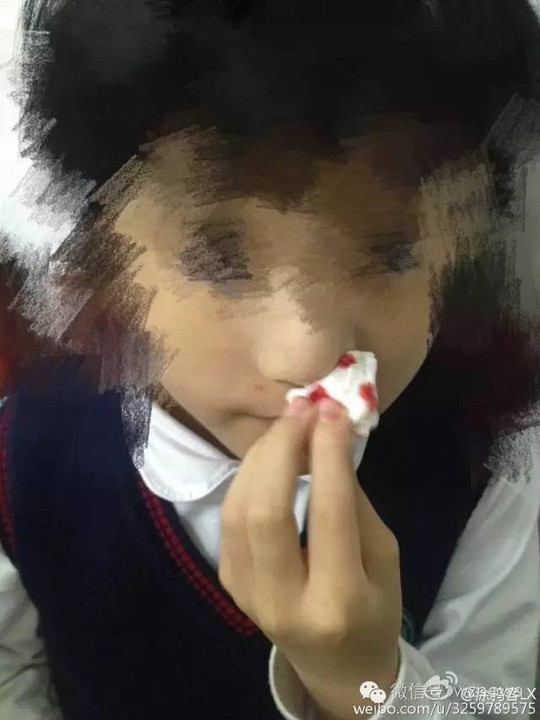 温州一小学被曝橡胶跑道有毒 多名学生流鼻血