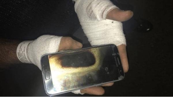 wzatv:【j2开奖】三星S7也出事了：手机发热后爆炸，受害者手部烧伤