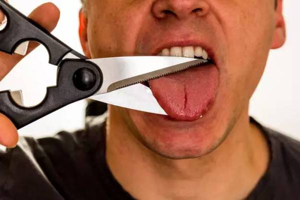 【j2开奖】历史上的14大奇葩疗法：你结巴吗？切掉舌头就好！